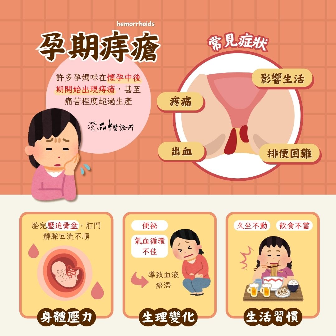 250627_pregnant_hemorrhoids_dr.Xie_info 250627_pregnant_hemorrhoids_dr.Xie_info