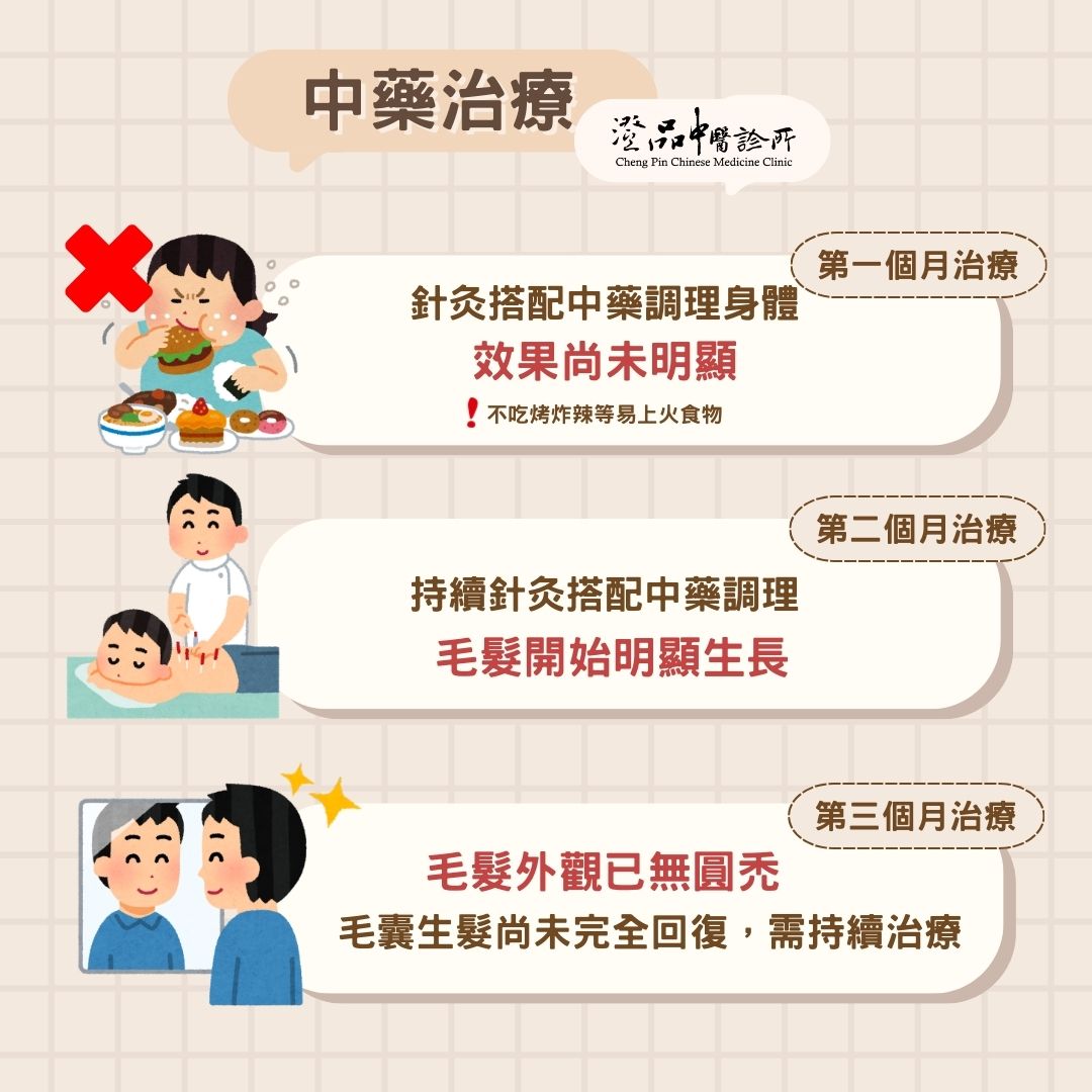 chengpin_drcsj_HairLoss_treatment chengpin_drcsj_HairLoss_treatment