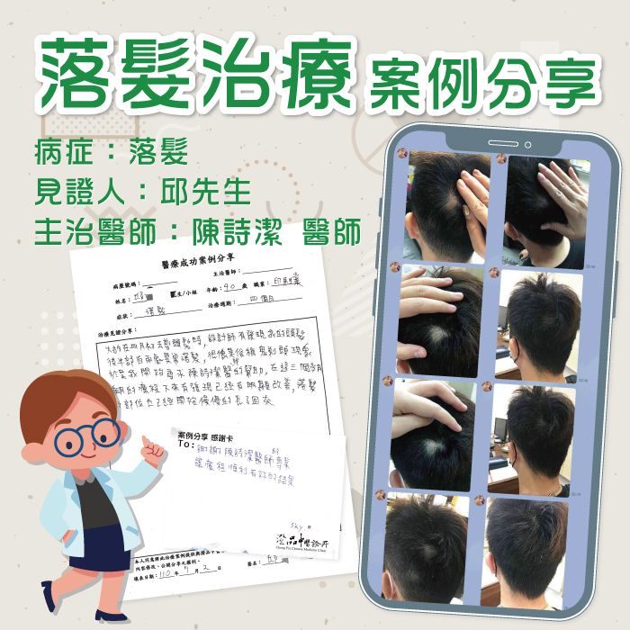 1100723-落髮_案分陳詩潔醫師 1100723-落髮_案分陳詩潔醫師