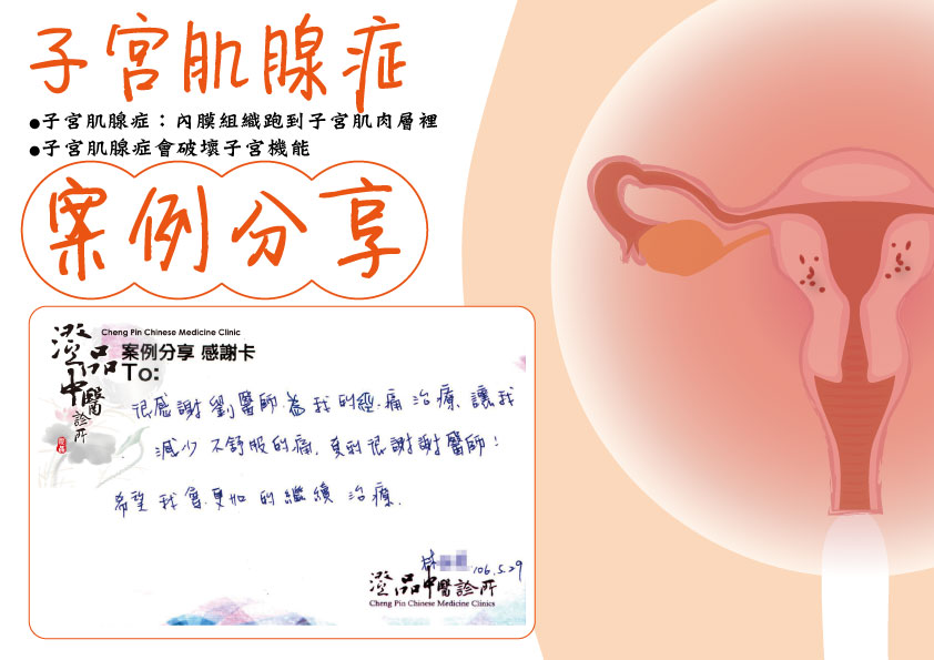 240827_Adenomyosis_dr.liu_case1 240827_Adenomyosis_dr.liu_case1