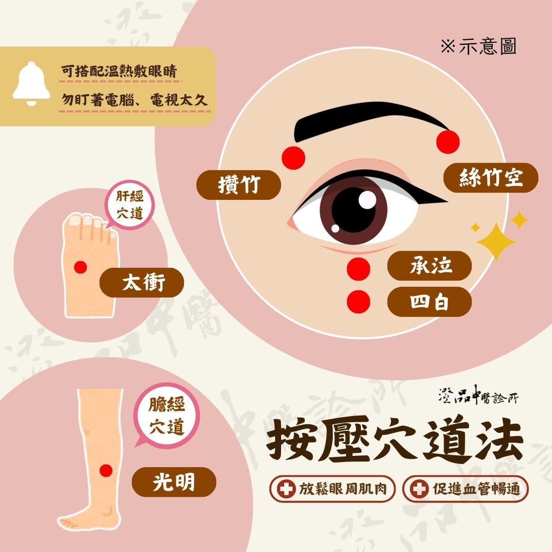 241106_eye_floaters_dr.heish_acupuncture_points 241106_eye_floaters_dr.heish_acupuncture_points