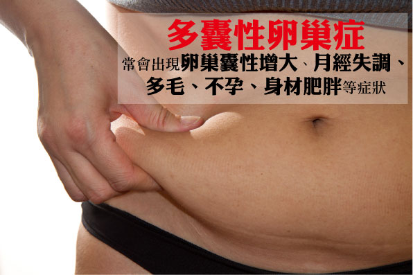 shutterstock_126522221肥胖 shutterstock_126522221肥胖